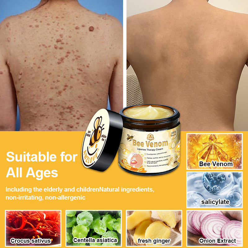 Awzlove™ Bee Venom Lipomas Therapy Cream (Doctor recommended and effective)🌟
