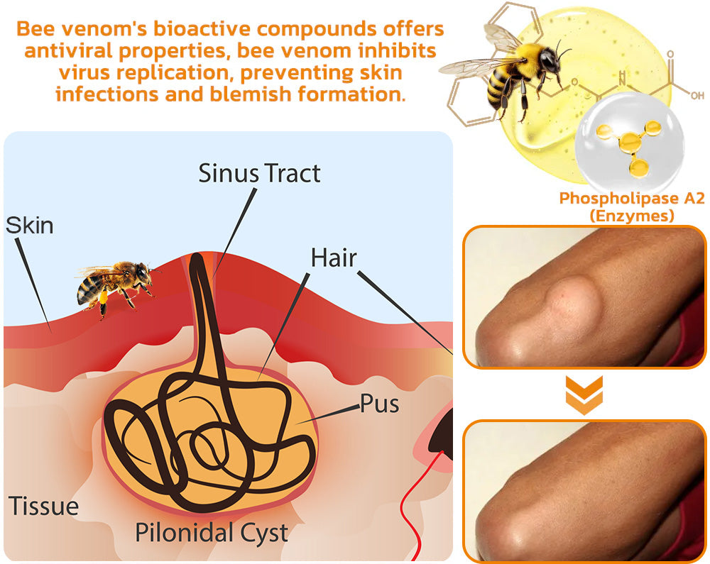 Awzlove™ Bee Venom Lipomas Therapy Cream (Doctor recommended and effective)🌟