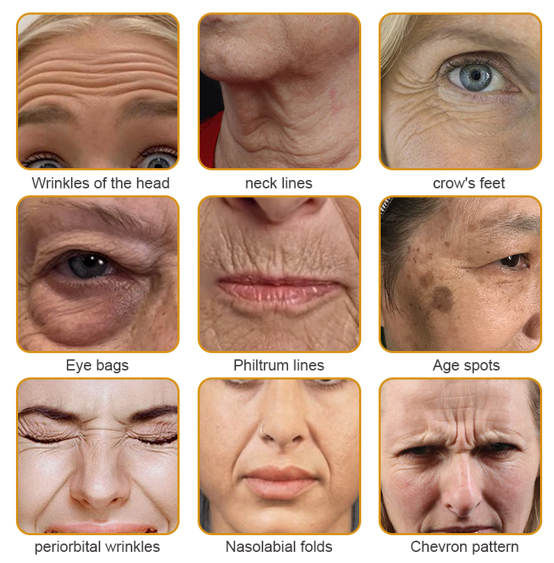 Awzlove™ AH-8 Botox Skin Firming Cream-Last Day Promotion 50% OFF