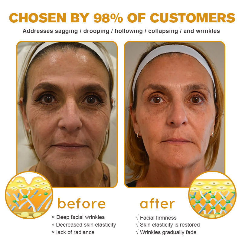 Awzlove™ AH-8 Botox Skin Firming Cream-Last Day Promotion 50% OFF