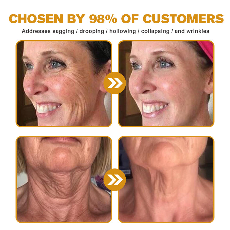 Awzlove™ AH-8 Botox Skin Firming Cream-Last Day Promotion 50% OFF