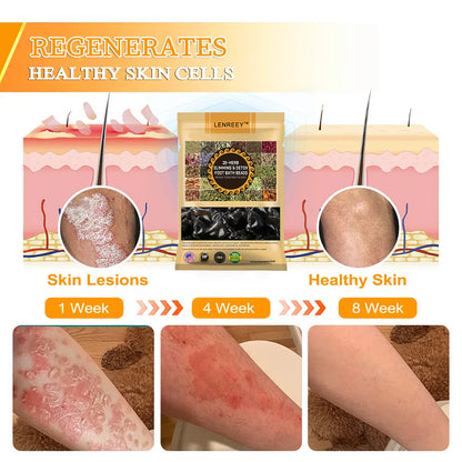 𝐋𝐞𝐧𝐫𝐞𝐞𝐲™ 𝟑𝟎-𝐇𝐞𝐫𝐛 𝐒𝐥𝐢𝐦𝐦𝐢𝐧𝐠 & 𝐃𝐞𝐭𝐨𝐱 𝐅𝐨𝐨𝐭 𝐁𝐚𝐭𝐡 𝐁𝐞𝐚𝐝𝐬-🪺🪺🪺(𝐋𝐀𝐍𝐀 𝐂𝐞𝐫𝐭𝐢𝐟𝐢𝐜𝐚𝐭𝐢𝐨𝐧，𝗟𝘆𝗺𝗽𝗵𝗮𝘁𝗶𝗰 𝗔𝘀𝘀𝗼𝗰𝗶𝗮𝘁𝗶𝗼𝗻 𝗼𝗳 𝗔𝗺𝗲𝗿𝗶𝗰𝗮)