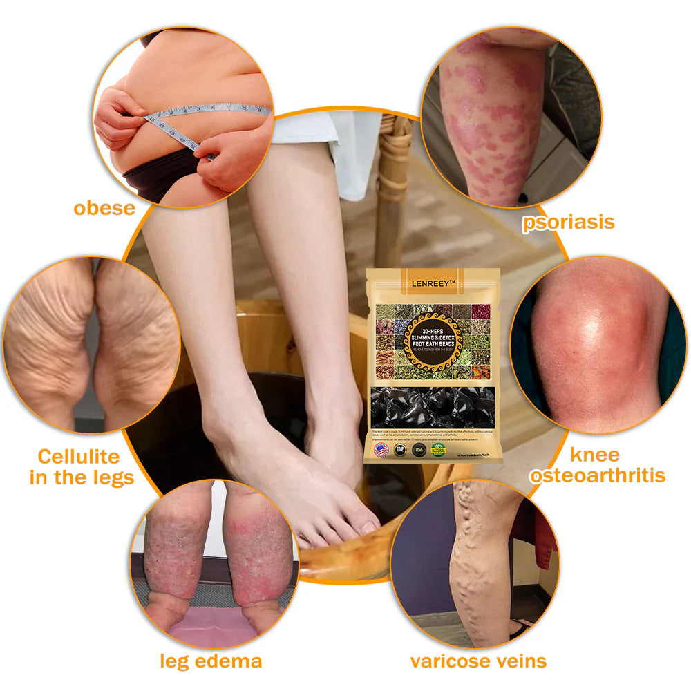 𝐋𝐞𝐧𝐫𝐞𝐞𝐲™ 𝟑𝟎-𝐇𝐞𝐫𝐛 𝐒𝐥𝐢𝐦𝐦𝐢𝐧𝐠 & 𝐃𝐞𝐭𝐨𝐱 𝐅𝐨𝐨𝐭 𝐁𝐚𝐭𝐡 𝐁𝐞𝐚𝐝𝐬-🪺🪺🪺(𝐋𝐀𝐍𝐀 𝐂𝐞𝐫𝐭𝐢𝐟𝐢𝐜𝐚𝐭𝐢𝐨𝐧，𝗟𝘆𝗺𝗽𝗵𝗮𝘁𝗶𝗰 𝗔𝘀𝘀𝗼𝗰𝗶𝗮𝘁𝗶𝗼𝗻 𝗼𝗳 𝗔𝗺𝗲𝗿𝗶𝗰𝗮)
