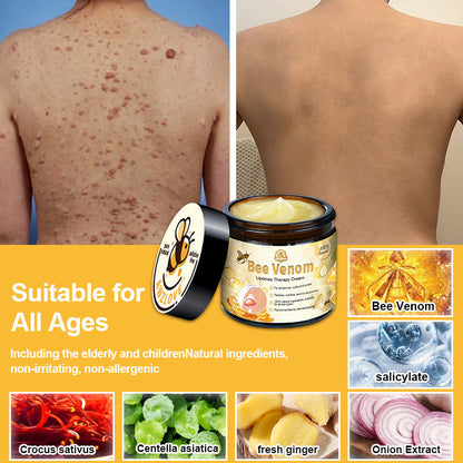 Awzlove™ Bee Venom Lipomas Therapy Cream (Doctor recommended and effective)🌟