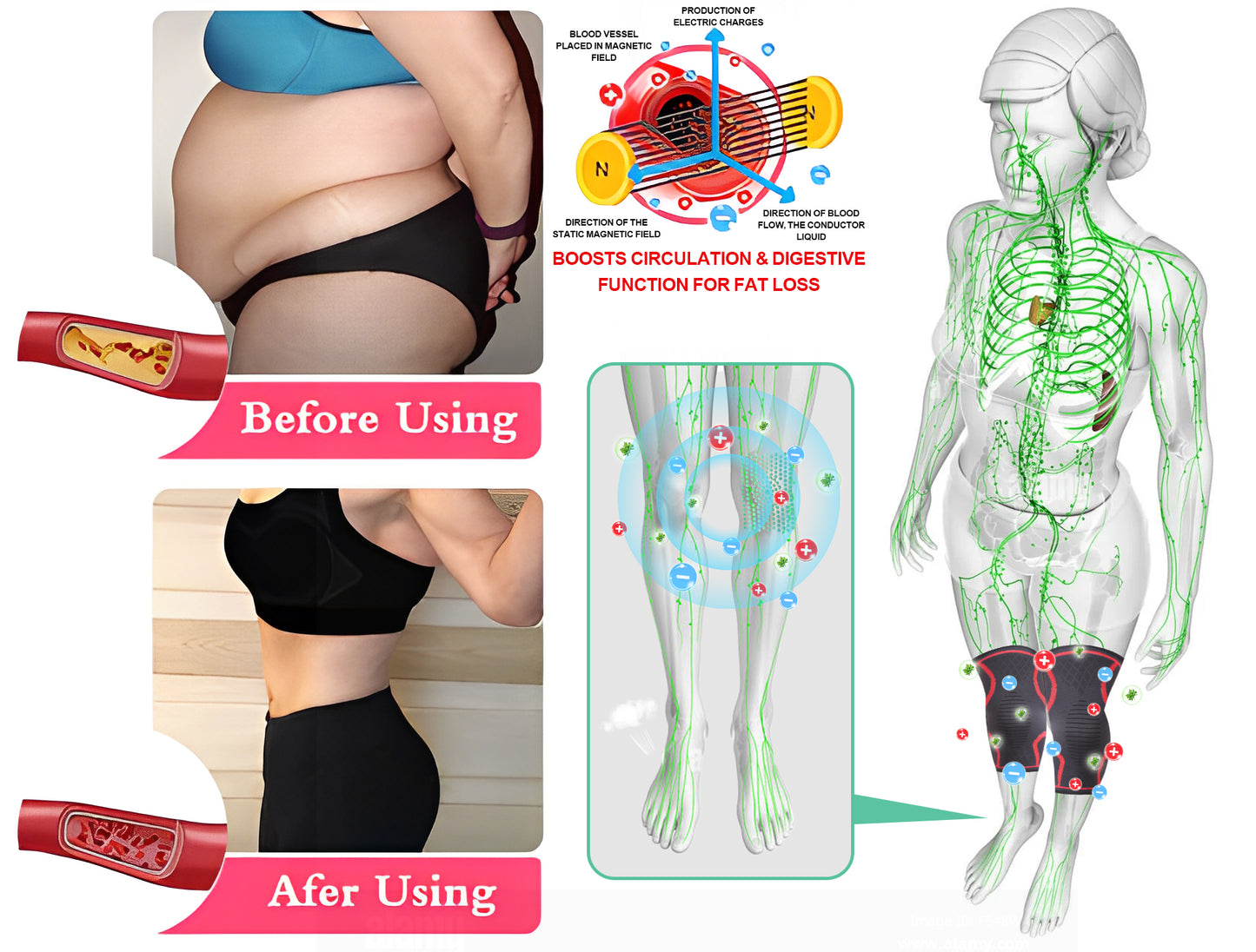 [Official Brand Store] EXPECTSKY® Ionic Enhanced Knee Brace for Total Joint Healing and Slimming with HIFEM, RF, and PEMF(⭐⭐⭐⭐⭐limited time offer, lasts 30 minutes)